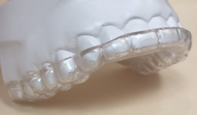 bruxism-clenching-guards_0.jpg