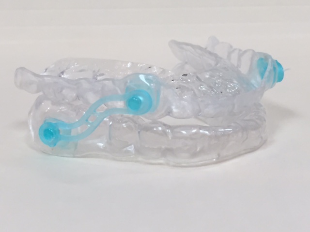 An oral appliance CPAP alternative