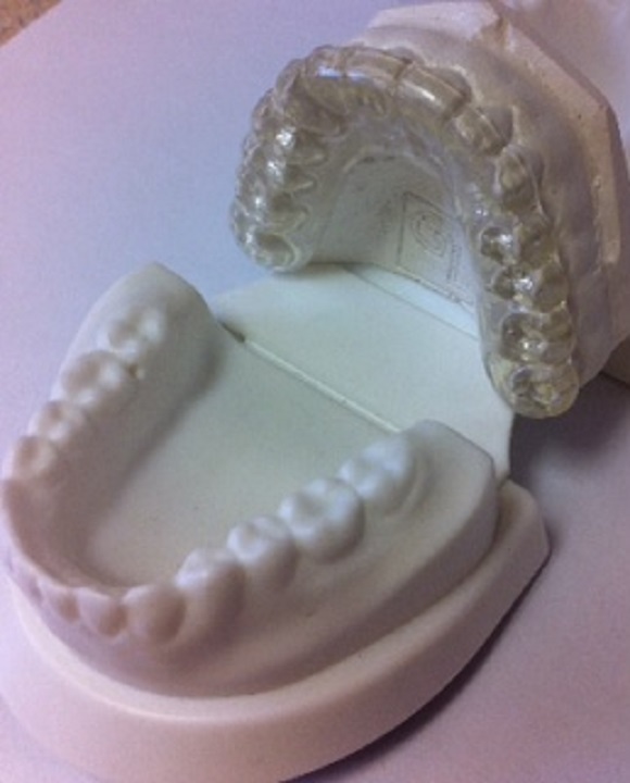 Bruxism Appliance